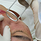 Skin Rejuvenation